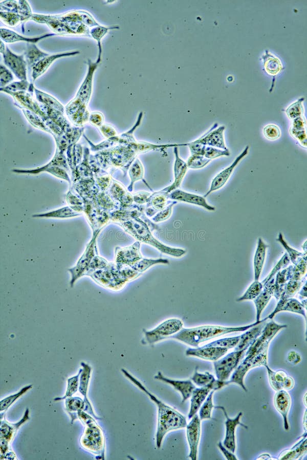 Mikroskop zobrazit pánská zdraví Prostaty buňky v tkáňové kultuře ukazuje stěny, jádra a organel.