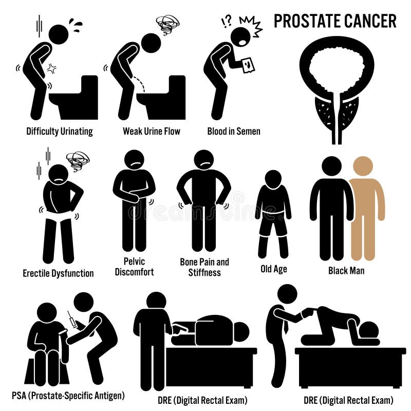 Prostate Cancer Clipart stock illustration