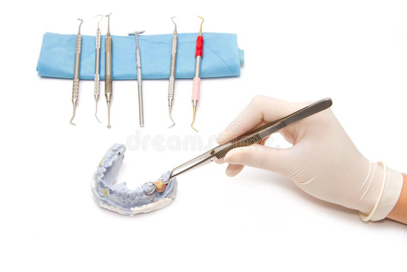 plâtre prothese dentaire