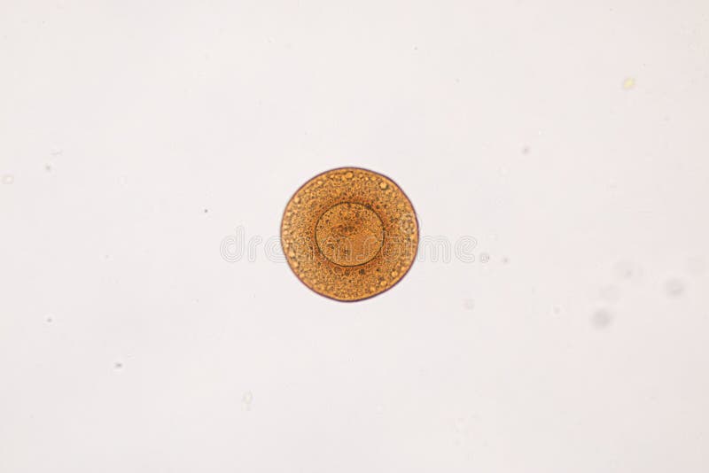 Protozoa and plant cells under the microscope for education. stock image