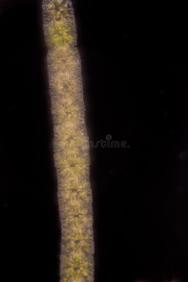 Protozoa and plant cells under the microscope for education. stock photography