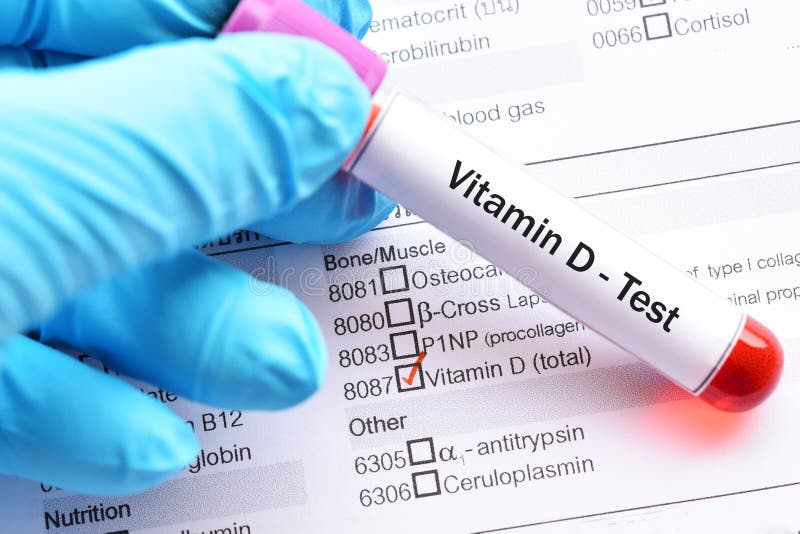 Prov för vitamin D