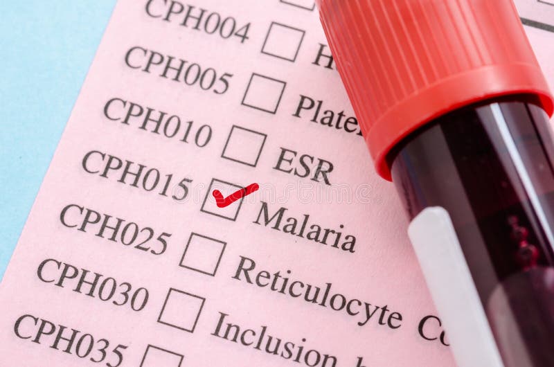 Provi il tubo del sangue sulla carta della forma della prova di malaria fotografia stock libera da diritti Provi il tubo del sangue sulla carta della forma della prova di malaria fotografia stock libera da diritti