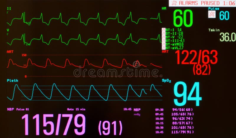 Przemierzający rytm z Przedwczesnym Kierowym rytmem obraz stock Przemierzający rytm z Przedwczesnym Kierowym rytmem obraz stock