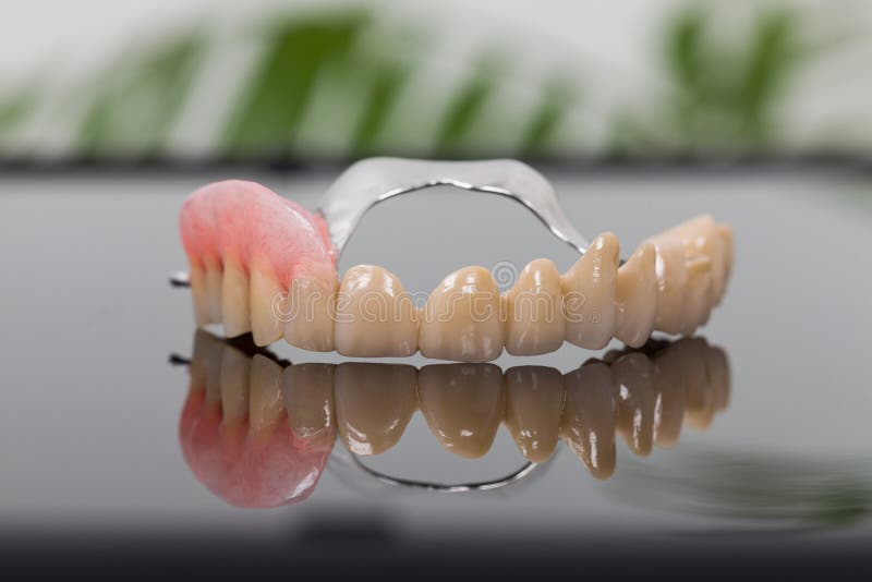 Prótese dental no laboratório imagens de stock Prótese dental no laboratório imagens de stock