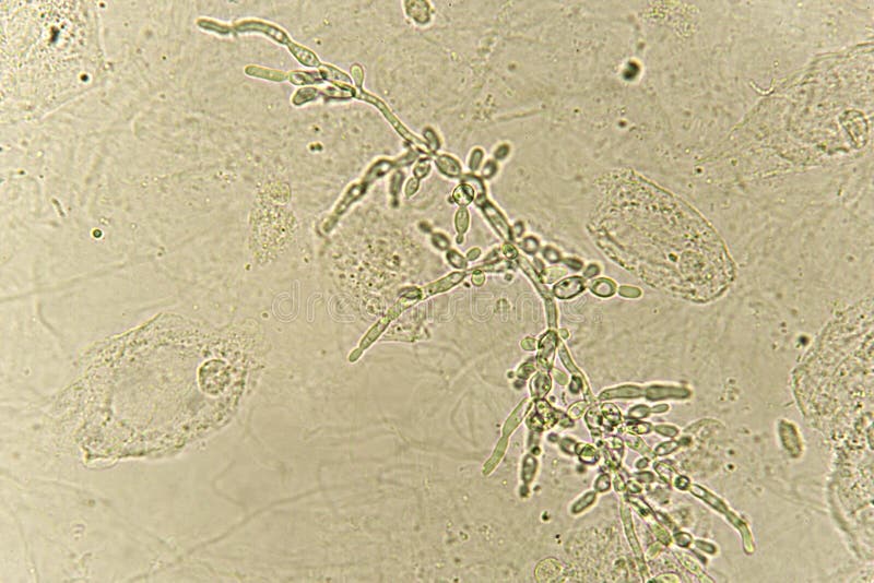 Дрожжевые клетки в моче повышены. Мицелий кандида. Грибы кандида лептотрикс. Грибы в моче под микроскопом. Дрожжевые грибы в моче.