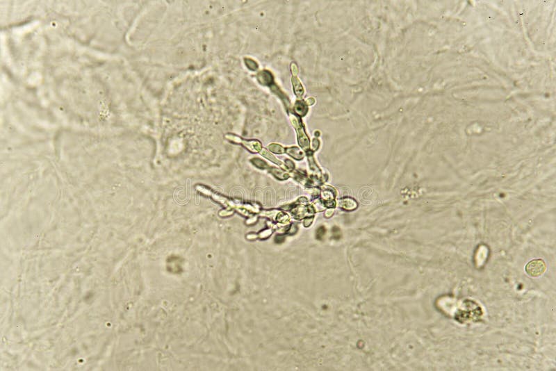 Roundworms May Reveal More About Aging-Related Diseases