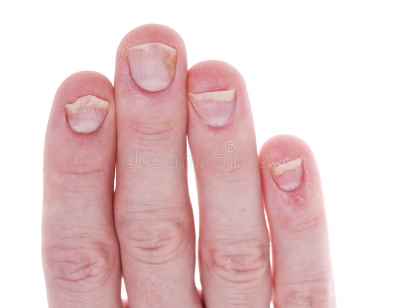 8 Common Skin & Nail Problems - Beaver Valley Foot Clinic