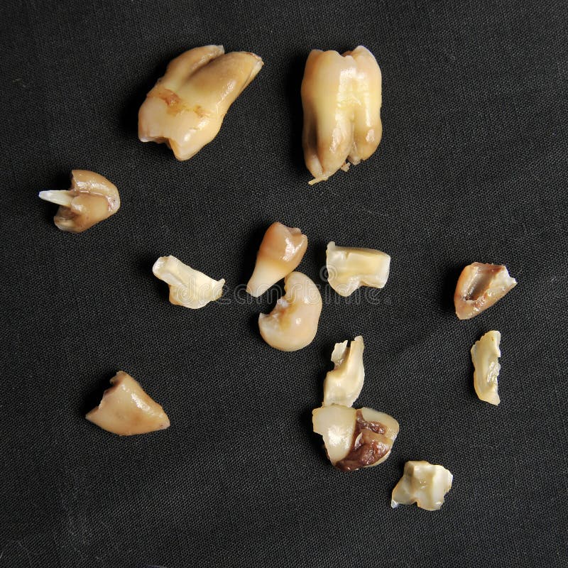 Pulled teeth on black stock images