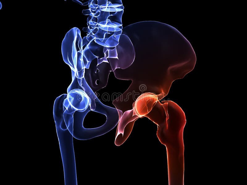 3d rendered x-ray illustration of a human skeletal hip with pain. 3d rendered x-ray illustration of a human skeletal hip with pain