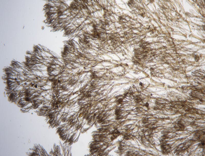 gå børste Begravelse Röda alger under mikroskop fotografering för bildbyråer. Bild av mikroskopi  - 194441169