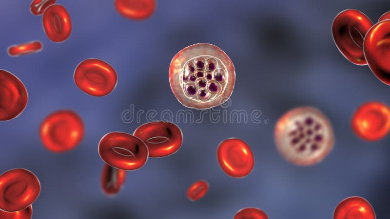 Röda Blodkroppar Infekterade Med Malaria Parasit ...