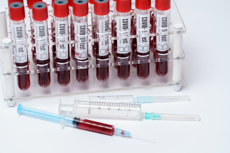 Rack of Tubes of Blood Sample for Testing Biological Material Stock