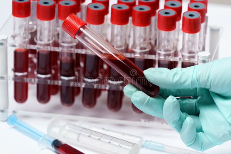 Rack of Tubes of Blood Sample for Testing Biological Material Stock