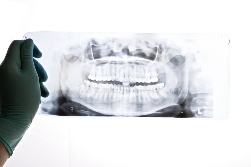 Radiografie stock afbeelding Radiografie stock afbeelding
