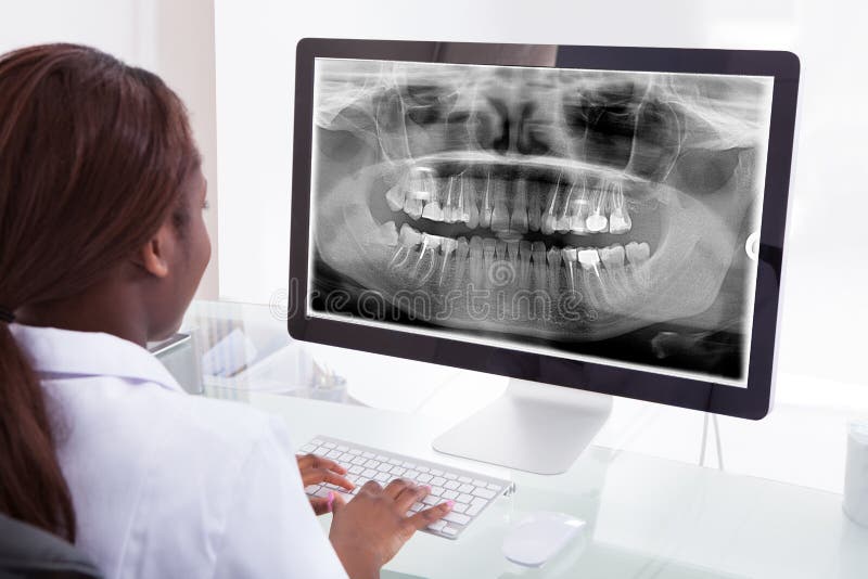 Radiografía de examen del mandíbula del dentista de sexo femenino en el ordenador en clínica