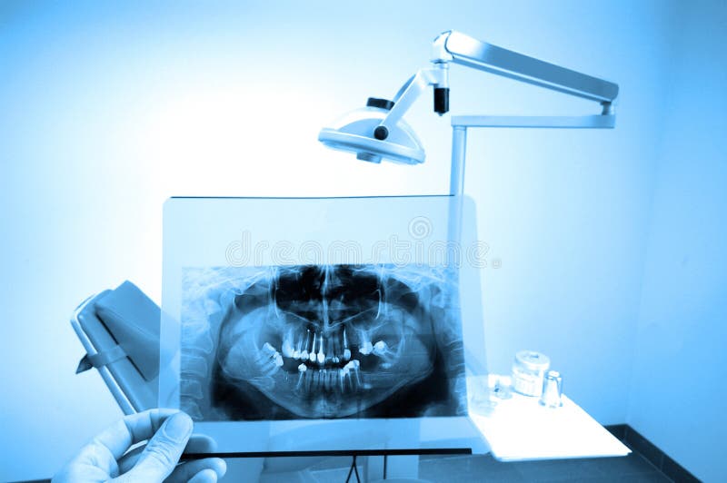 Radiografía dental imagen de archivo Radiografía dental imagen de archivo