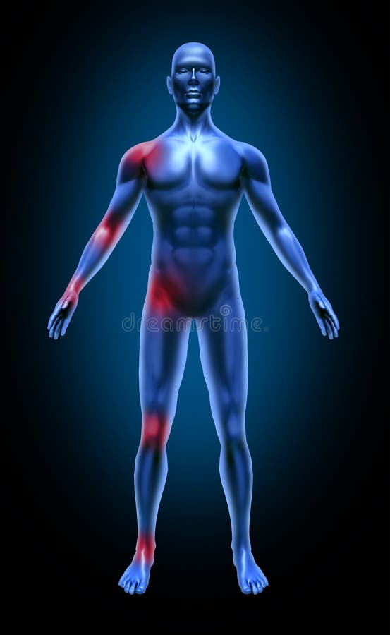 Radiografía médica de la inflamación del dolor común del cuerpo humano