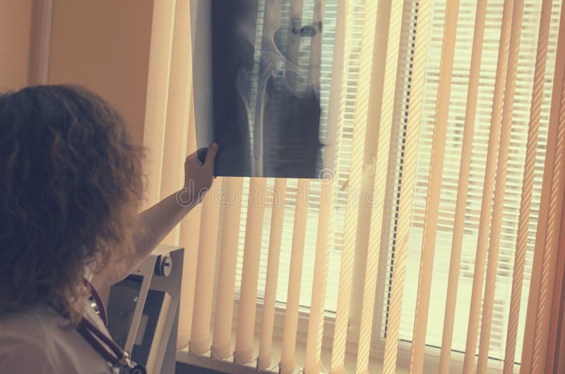 A Radiologist with a Stethoscope on the Neck is Watching an Xray of an