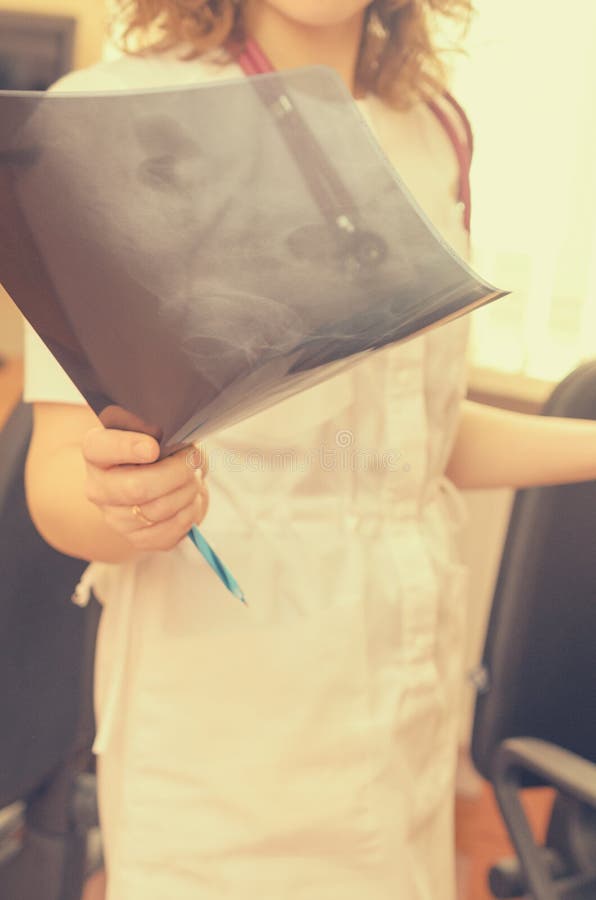A Radiologist with a Stethoscope on the Neck is Watching an Xray of an
