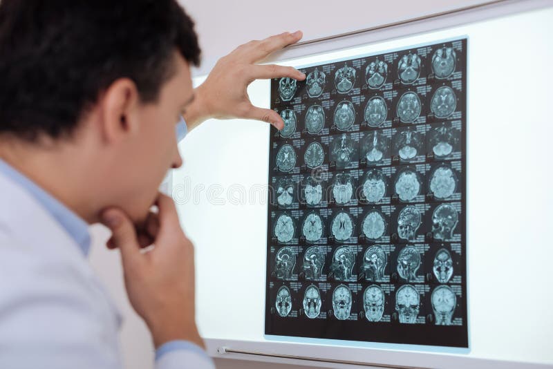 Radiologista pensativo sério que procura uma patologia do cérebro fotos de stock Radiologista pensativo sério que procura uma patologia do cérebro fotos de stock