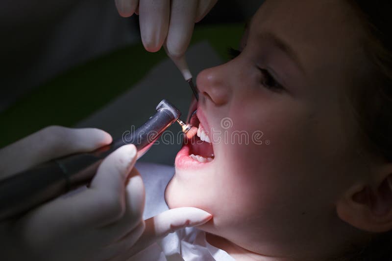 Ragazza che ottiene i suoi denti lucidati immagini stock libere da diritti Ragazza che ottiene i suoi denti lucidati immagini stock libere da diritti