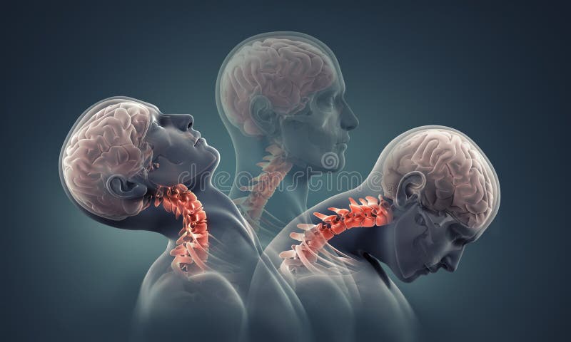 Raggi x dell'uomo con le ossa di collo evidenziate immagini stock libere da diritti Raggi x dell'uomo con le ossa di collo evidenziate immagini stock libere da diritti