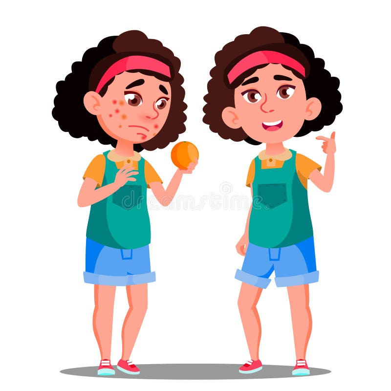 Reacción alérgica, muchacha triste con los puntos rojos que llevan a cabo un vector anaranjado Ejemplo aislado de la historieta ilustración del vector Reacción alérgica, muchacha triste con los puntos rojos que llevan a cabo un vector anaranjado Ejemplo aislado de la historieta ilustración del vector