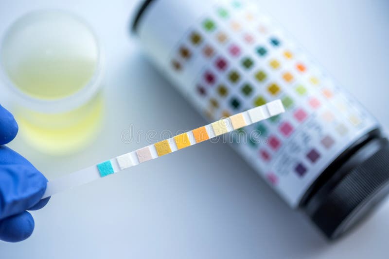 Urine for sugar test