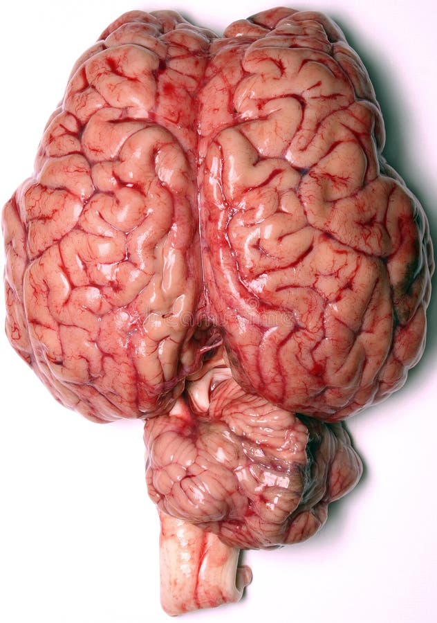 Real Brain stock image. Image of closeup, head, surgery - 146097