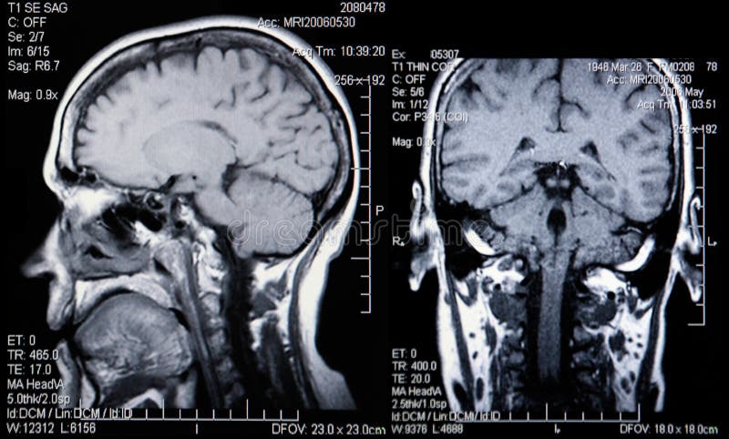 Doble de esta probando de cabeza a cerebro.