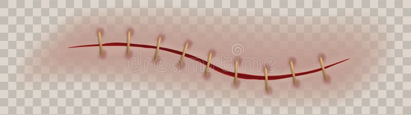 Wound Stock Illustrations – 18,234 Wound Stock Illustrations, Vectors &  Clipart - Dreamstime