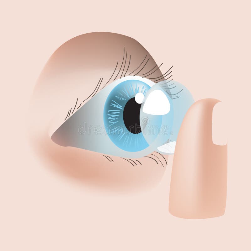 Realistic Style Vector Illustration with Eye and Contact Lens Stock Vector  - Illustration of vision, care: 95383888