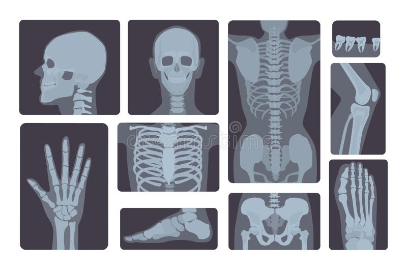 Realistische Röntgenstrahlschusssammlung Hand, Bein, Schädel, Fuß, Kasten, Zähne, Dorn und anderer des menschlichen Körpers lizenzfreie abbildung Realistische Röntgenstrahlschusssammlung Hand, Bein, Schädel, Fuß, Kasten, Zähne, Dorn und anderer des menschlichen Körpers lizenzfreie abbildung