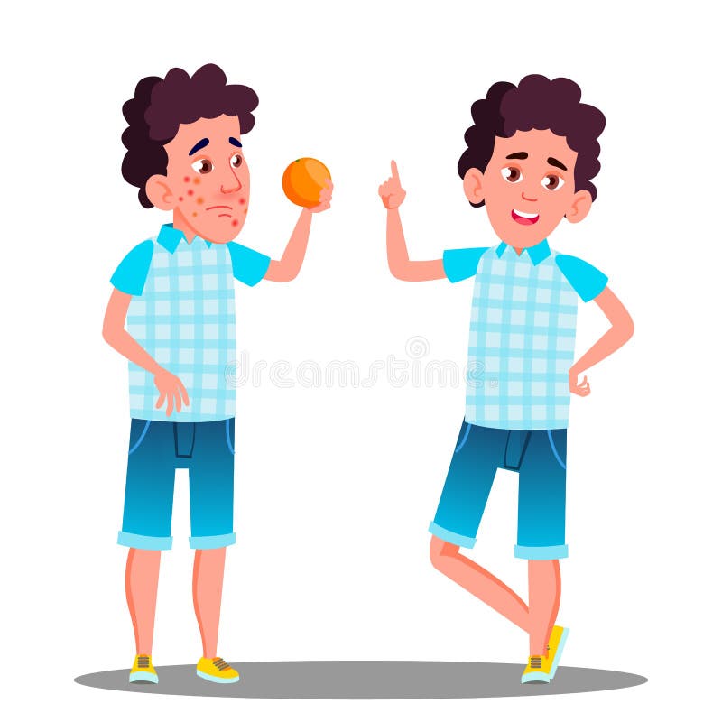 Reazione allergica, ragazzo triste con i punti rossi che tengono un vettore arancio Illustrazione isolata del fumetto royalty illustrazione gratis Reazione allergica, ragazzo triste con i punti rossi che tengono un vettore arancio Illustrazione isolata del fumetto royalty illustrazione gratis