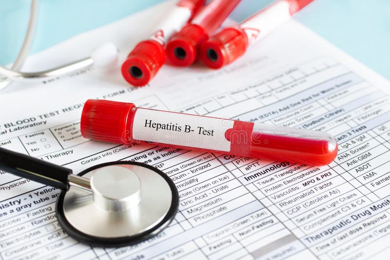 Hepatitis Test, Blood In The Test Tube Stock Image - Image of ...