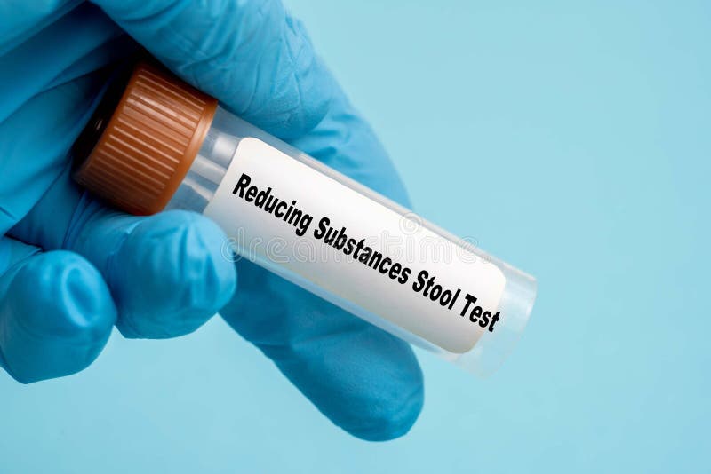Reducing Substances Stool Test stock illustration