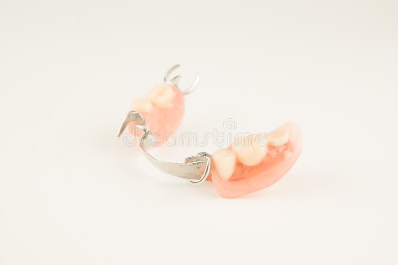Removable Dental Prosthesis with a Metal Arc in the Hands of a Doctor