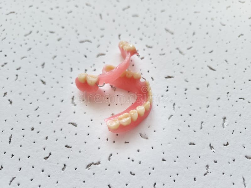 Removable Dentures for the Patient are Made in a Dental Laboratory