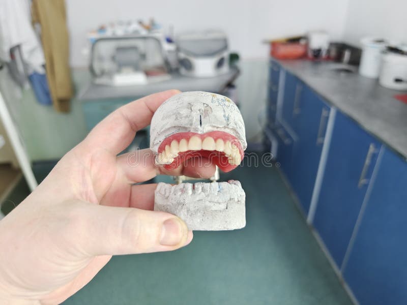 Removable Dentures for the Patient are Made in a Dental Laboratory
