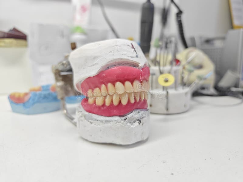 Removable Dentures for the Patient are Made in a Dental Laboratory