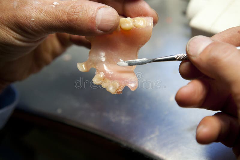 Repairing Artificial Human Teeth Stock Image Image of bone, focus