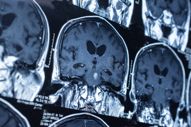 Research in medicine. CT scan of the patient. stock photo