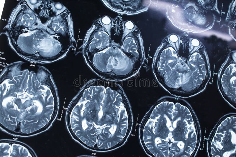 Research in medicine. CT scan of the patient. stock images