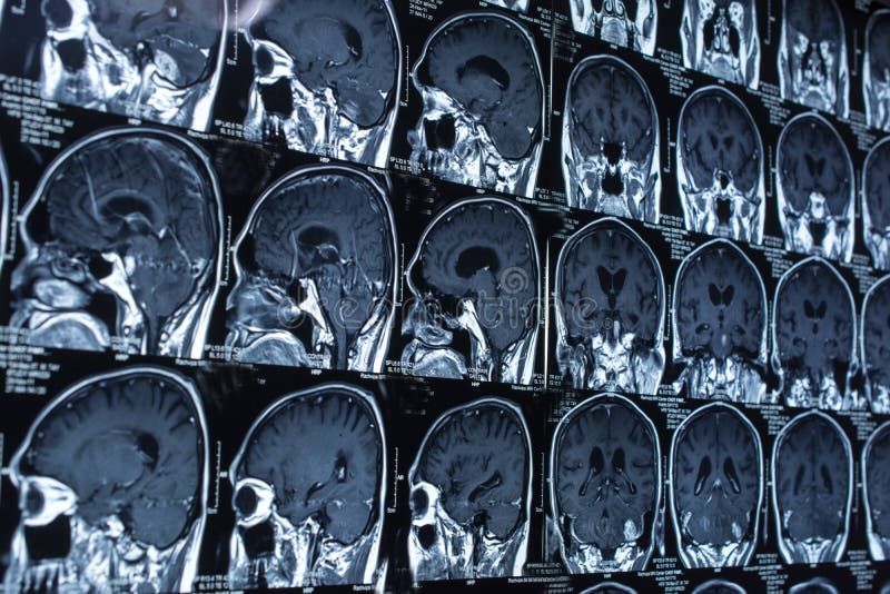 Research in medicine. CT scan of the patient. stock images