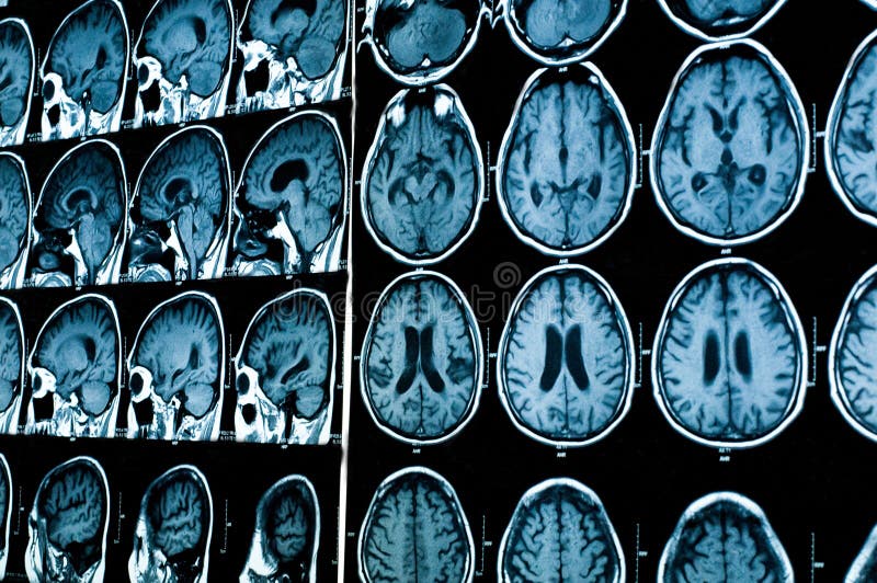 Research in medicine. CT scan of the patient. stock photos