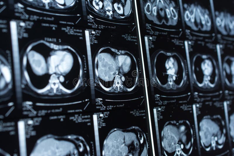 Research in medicine. CT scan of the patient. stock images