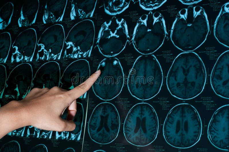 Research in medicine. CT scan of the patient. stock photo