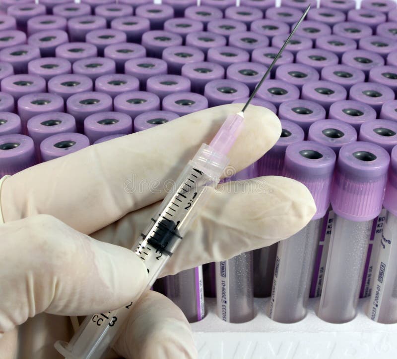 Research test tubes stock photo