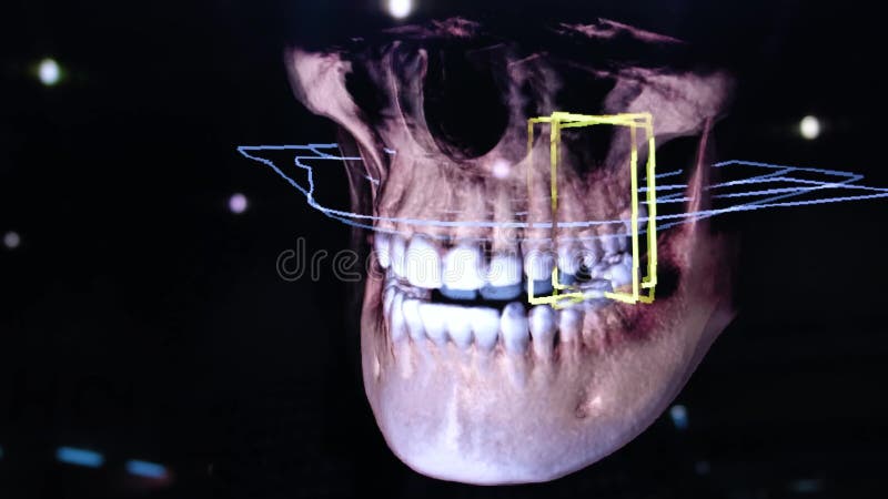 restauração dental da modelagem 3D digital modelo 3d dos dentes, dentes feitos a varredura do paciente O doutor é estudar